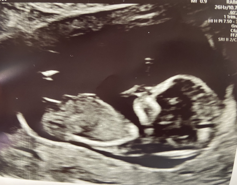 August Due Date Crew - Into Trimester 2 (Thread 6)
