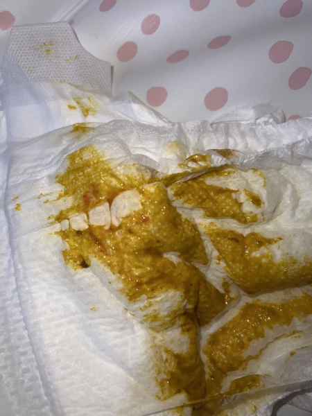 Blood in 3 month old poo 