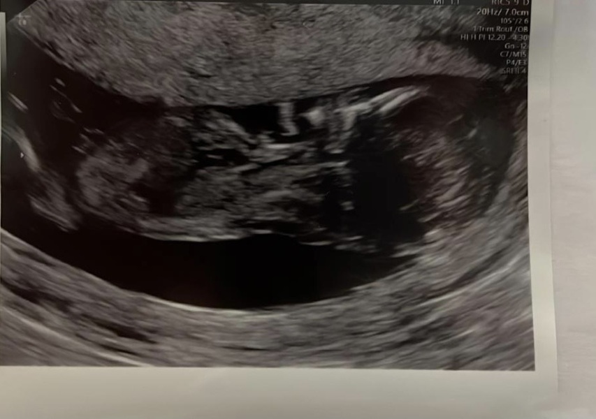 Gender guesses
