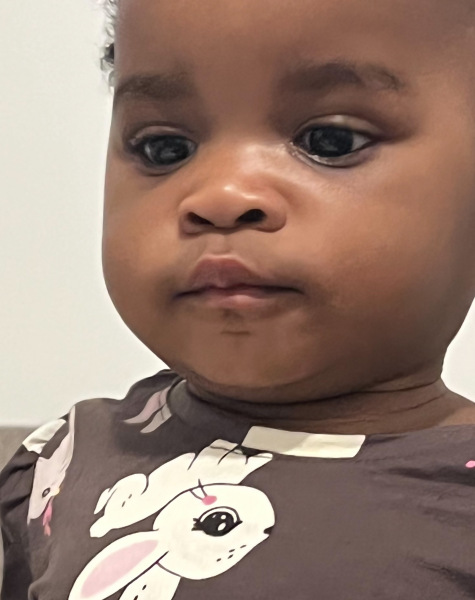 Please be kind. Small Eyes?