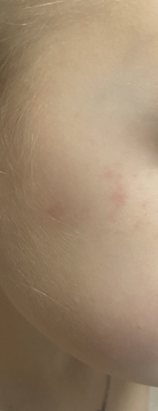Strep? Viral?