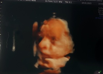 4D scan