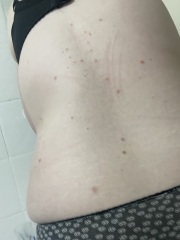 Can anyone help with spotty rash?