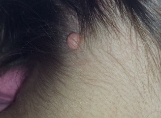Any idea what this is on the back of my neck?