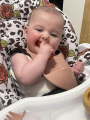 Mass on brain 4 month old baby