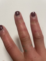 Help diagnose my hands (photo)