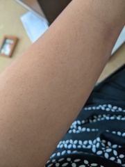 What are these spots on my arm?