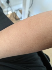 What are these spots on my arm?