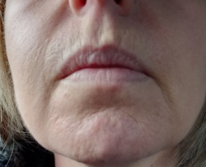Help with skin ageing