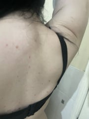 Can anyone help with spotty rash?