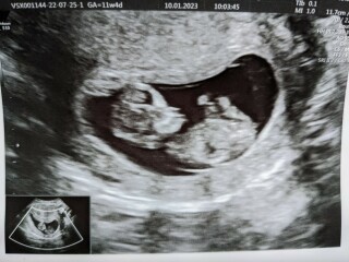 11+4/5 gender guesses?