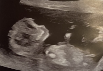 Due March 2023 - thread 5