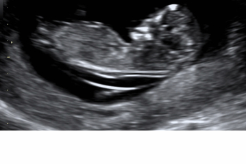 Boy or girl?