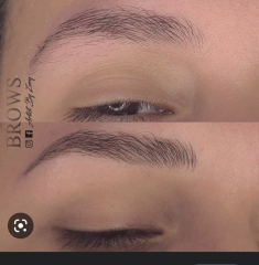 Cosmetic surgery DOES affect others