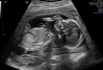 June 2023 Babies ☀️ (Thread 3) 