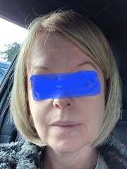 Help with skin ageing