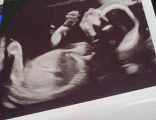 Boy or girl :D