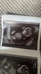 Just for fun do we think baby is a boy or girl
