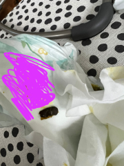 What is this? Foreign object in baby's poo? (Sorry there's a pic)