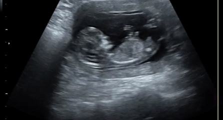 Any chance of gender guesses!?