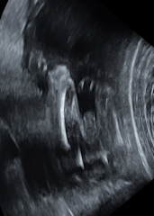 Due March 2023 - thread 5