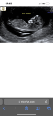 Boy or girl?! :)