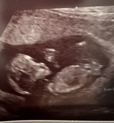 Boy or girl? 