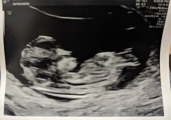 11+4/5 gender guesses?