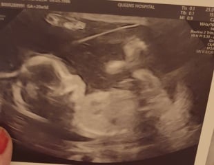 June 2023 Babies ☀️ (thread four)