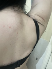 Can anyone help with spotty rash?