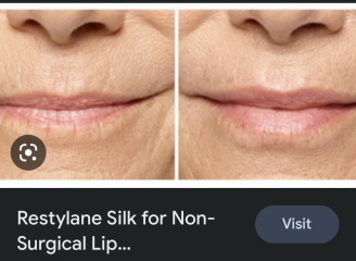 Cosmetic surgery DOES affect others