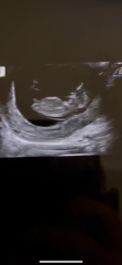 Boy or girl?