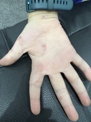 Please tell me what’s going on with my child’s skin (pictures included)