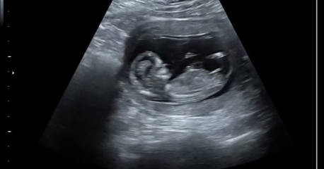 Any chance of gender guesses!?