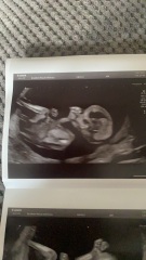 Just for fun do we think baby is a boy or girl