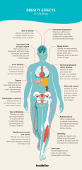 Most horrifying facts about obesity?