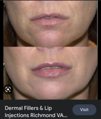 Cosmetic surgery DOES affect others