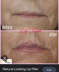 Cosmetic surgery DOES affect others