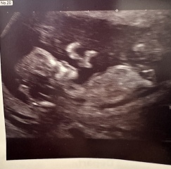 Boy or girl? 