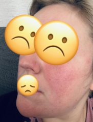 What is wrong with me? Pictures included.