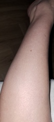 Will a lumea work (with hairy leg pics)?