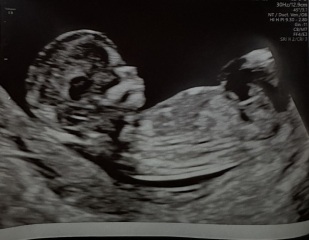 Had girl and boy guesses? What do you think?