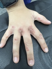 Please tell me what’s going on with my child’s skin (pictures included)