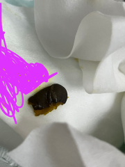 What is this? Foreign object in baby's poo? (Sorry there's a pic)