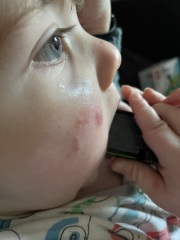 What is this (spotty face)?