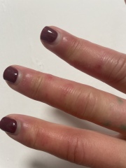 Help diagnose my hands (photo)