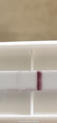 Did I miscarry?