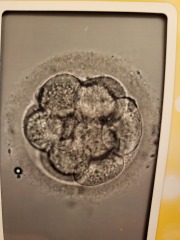 FET/IVF - January 2023
