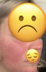 What is wrong with me? Pictures included.