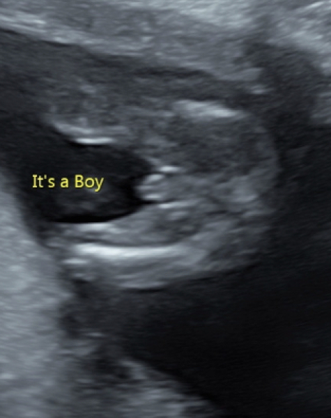 Due July 2023 thread 2